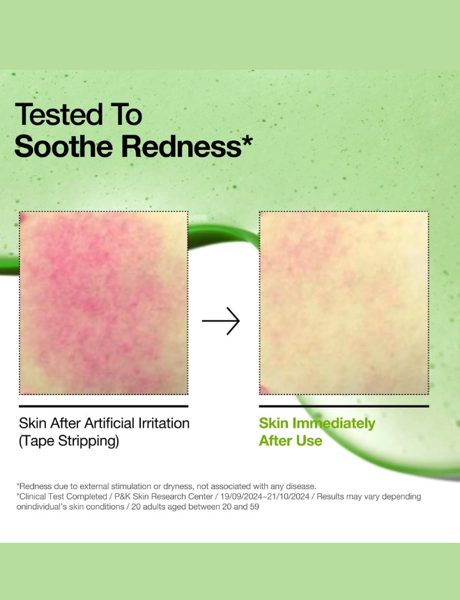 Second image of Anua Azelaic Acid 10 Hyaluron Redness Soothing Serum 30ml