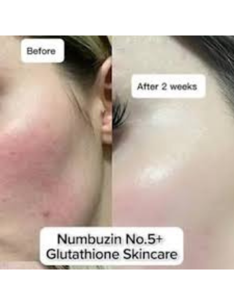 Second image of Numbuzin No.5+ Vitamin Glutathione Dark Spot Laser 50ml