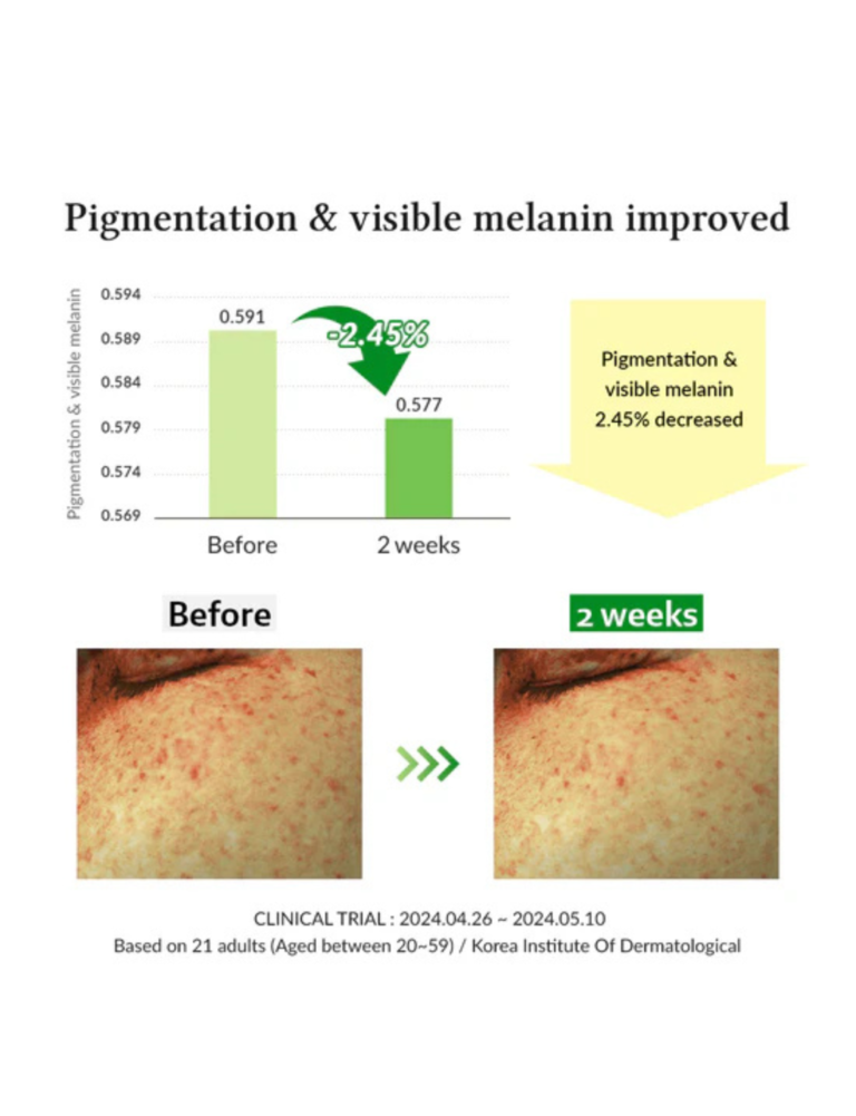 Second image of DR ALTHEA Gentel Vitamin C Serum (20%) 30ml