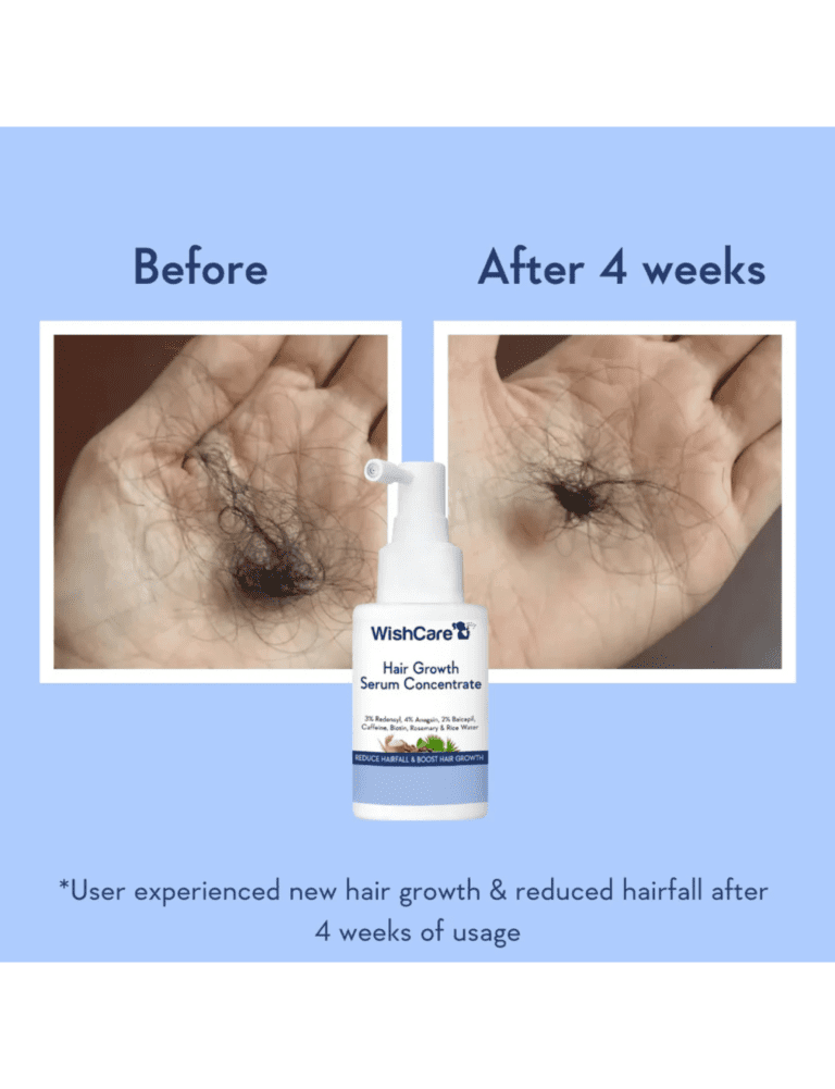 Second image of Wishcare Hair Growth Serum Concentrate